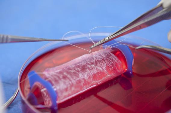 Handout photo of Dr Yuanyuan Zhang demonstrating the process to engineer a vaginal organ